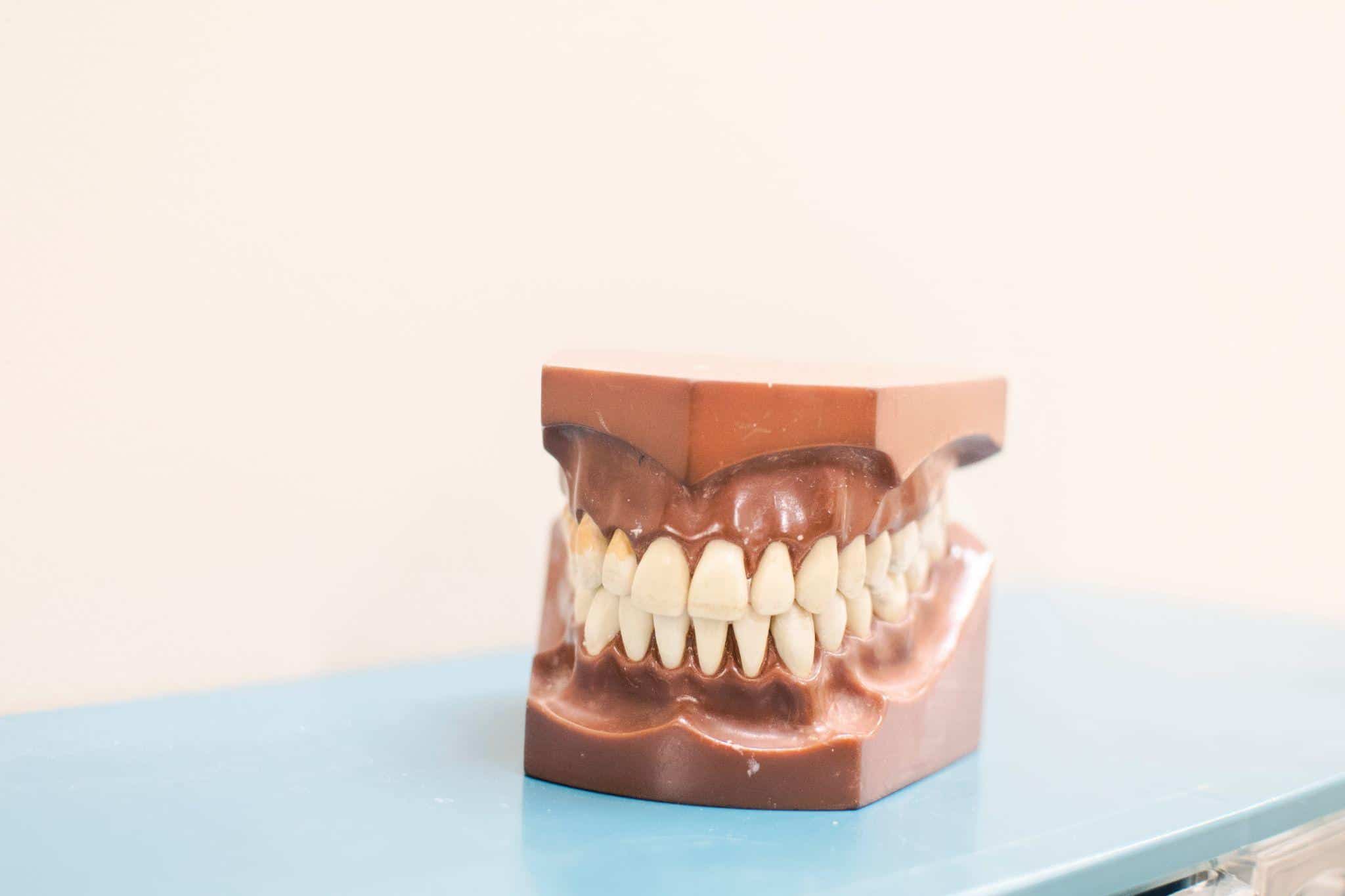 Geek insider, geekinsider, geekinsider. Com,, can tooth decay cause other health problems? , living